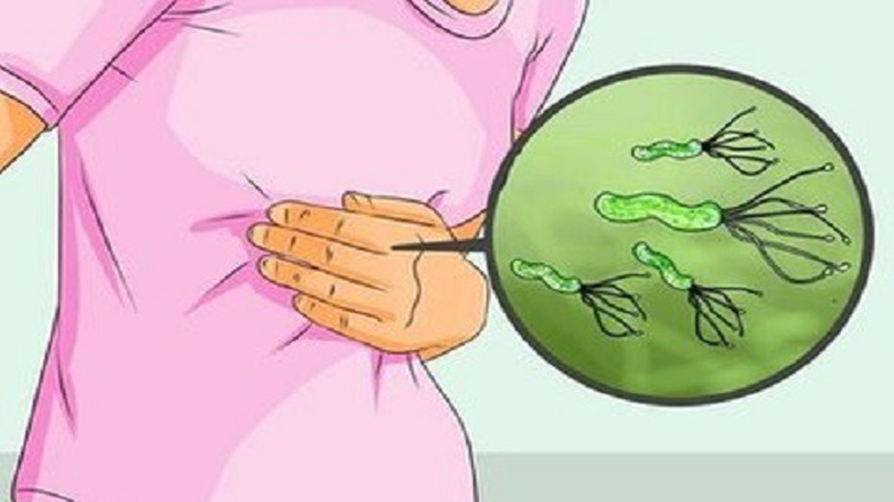 出現(xiàn)胃疼、腹脹應(yīng)提防感染幽門螺桿菌