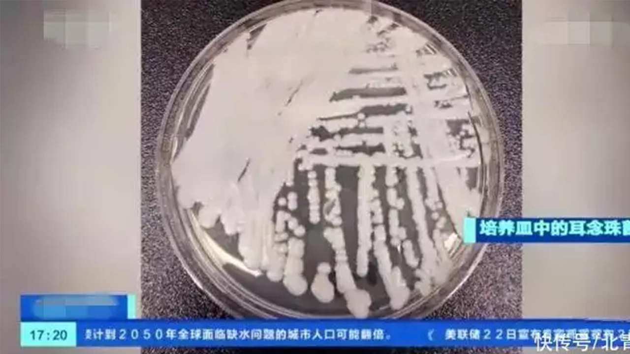 在美迅速傳播的耳念珠菌，我們需要擔(dān)心嗎