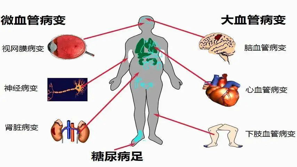 【醫(yī)院動態(tài)】聯(lián)合國糖尿病日|糖尿病與幸福感